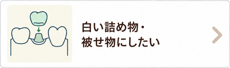 白い詰め物・被せ物にしたい