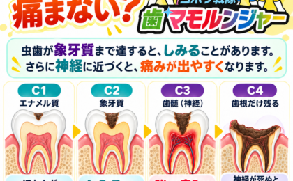 痛みを待たずに虫歯対策｜C1〜C4の進行を知ろう【越谷みんなの歯科・矯正歯科クリニック】